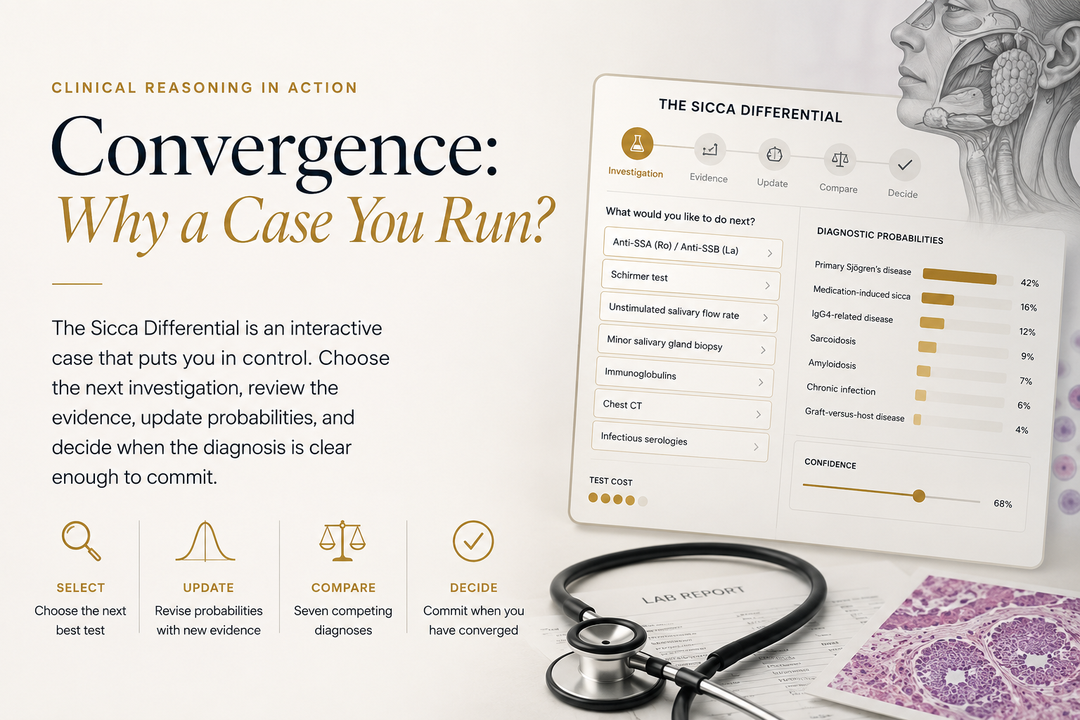 The Sicca Differential- case simulation