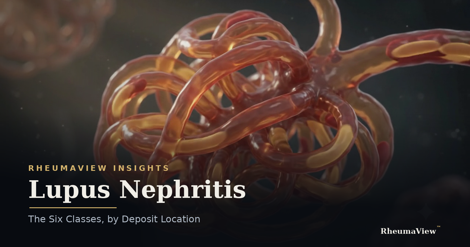 Lupus Nephritis by Class